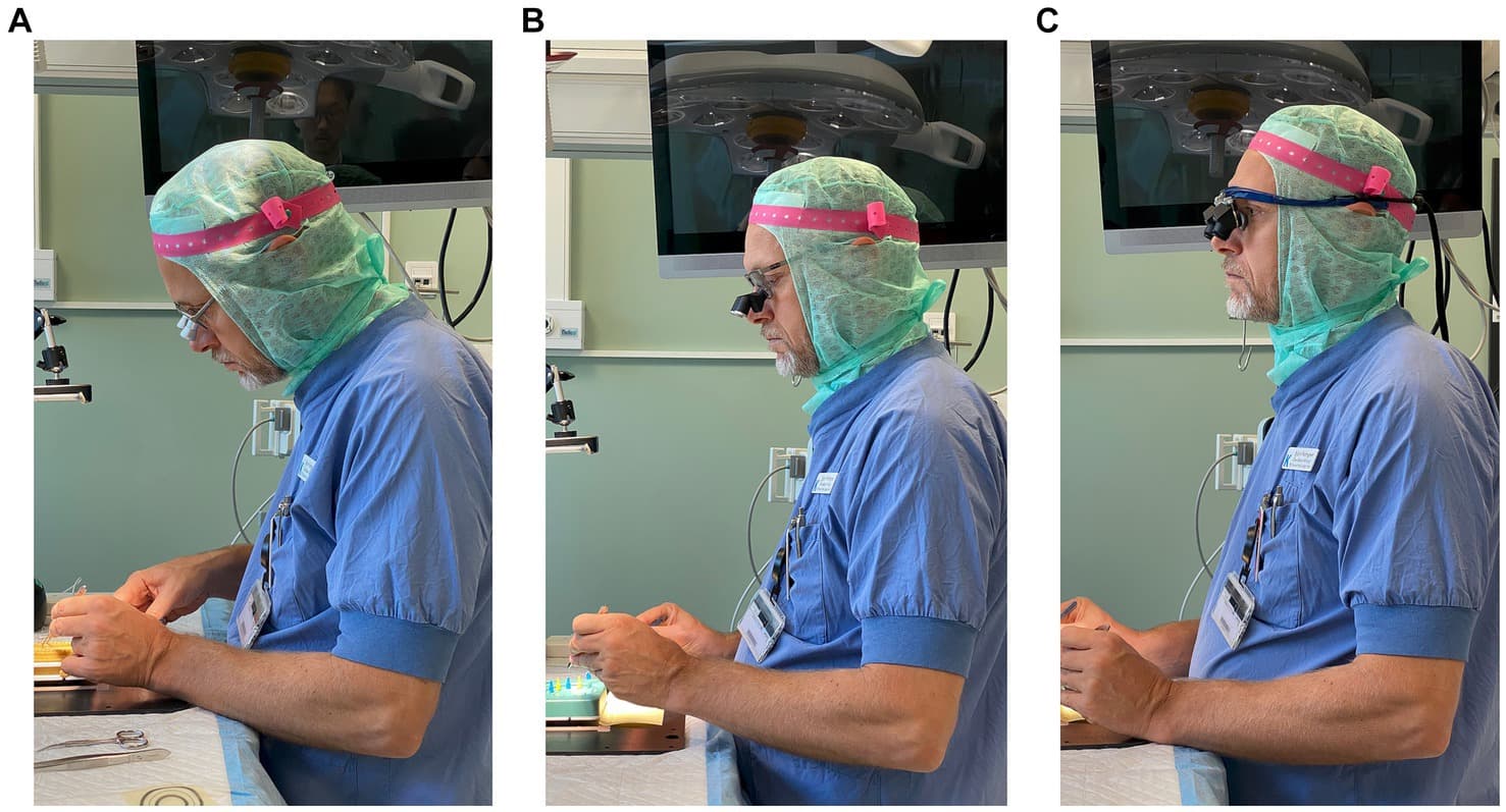 Side-view photographs of a surgeon working with three different loupe configurations: traditional loupes (A), low-tilt prismatic loupes (B), and high-tilt prismatic loupes (C), showing progressively reduced head flexion.